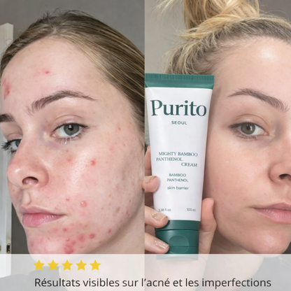 Purito Antiacné Corps et Visage Purskin™