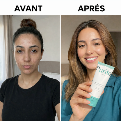 Purito Antiacné Corps et Visage Purskin™